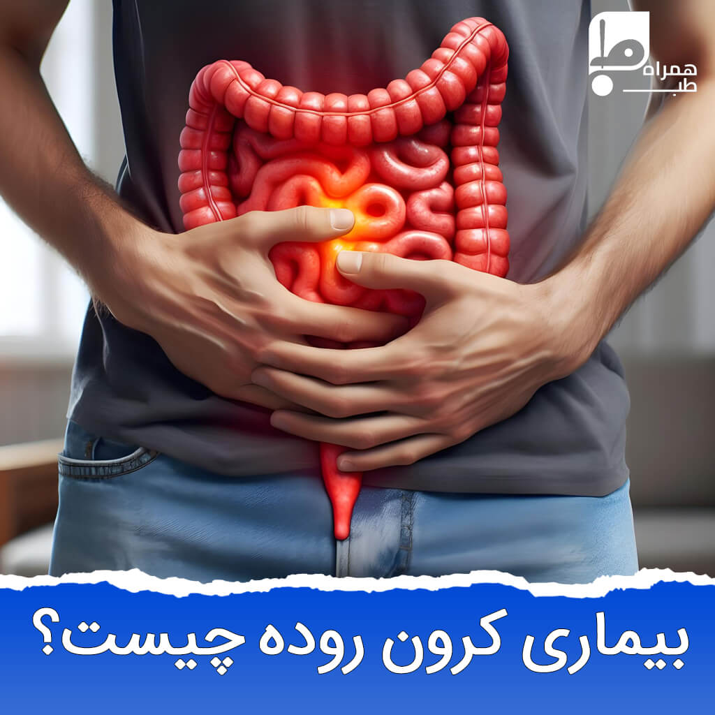 علت‌یابی تا درمان خانگی بیماری کرون روده