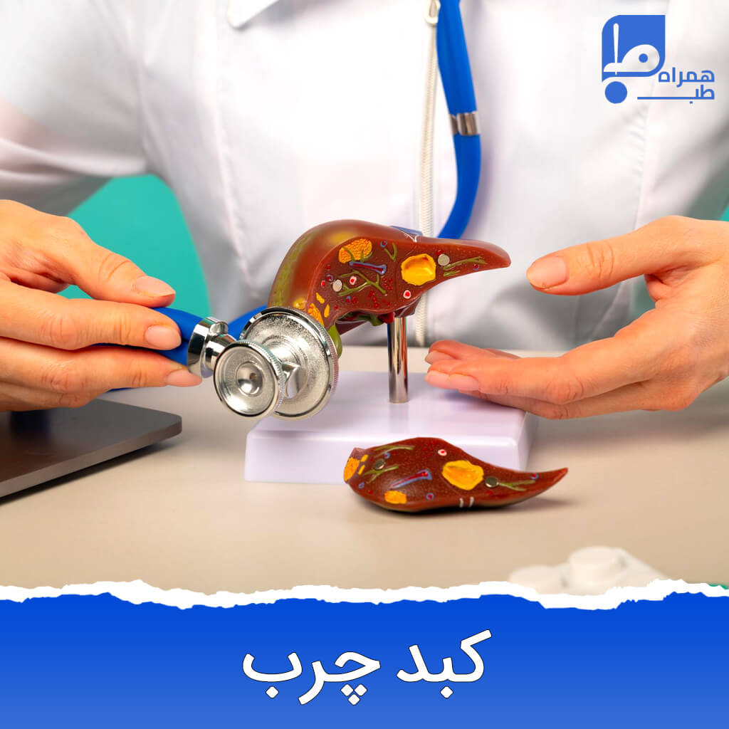 کبد چرب 