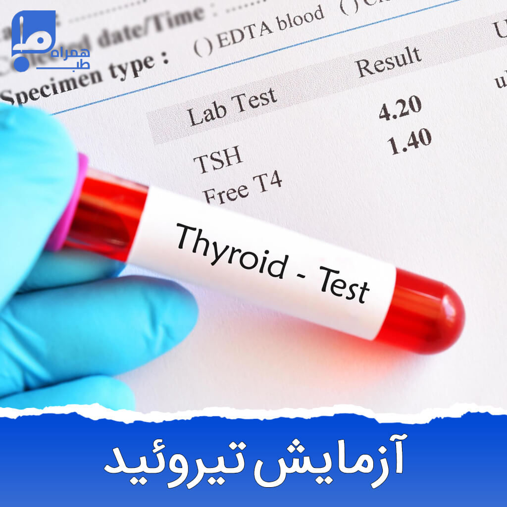 جدول تفسیر آزمایش تیروئید
