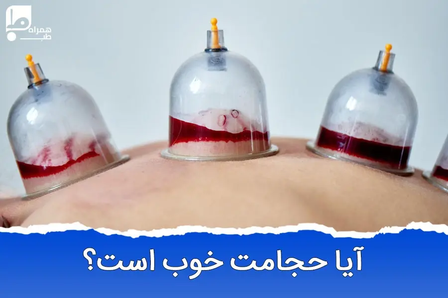 فواید حجامت: بررسی علمی و کاربردی حجامت برای سلامت بدن