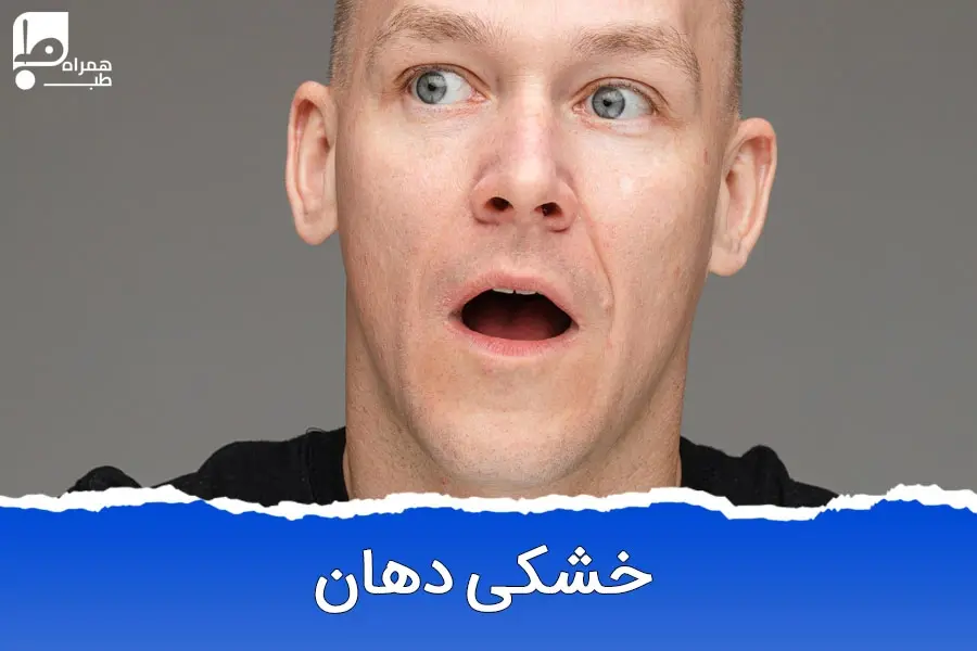 رازهای خشکی دهان: علل، علائم و راه‌های موثر درمان